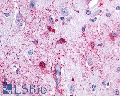 PathPlus™ Polyclonal Rabbit anti-Human HTR7 / 5HT7 Receptor Antibody (C-Terminus, IHC)