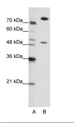 SSB / La Antibody (aa82-131)