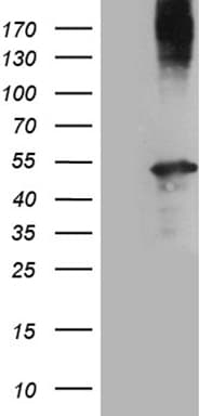 AMDHD1 Antibody (clone OTI2D3, Carrier-free)