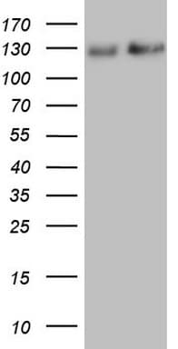 Monoclonal Mouse anti-Human NEFM / NF-M Antibody (clone OTI2G3, aa413-773, IHC, WB)