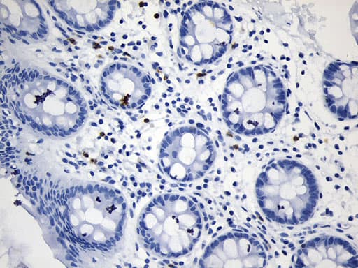 Monoclonal Mouse anti-Human CD8A / CD8 Alpha Antibody (clone UMAB241, aa22-182, IHC)