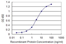 IHC-plus™ TPM3 Antibody (clone 2E4)