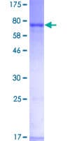 Human ISGF3 / IRF9 Protein (Recombinant GST)
