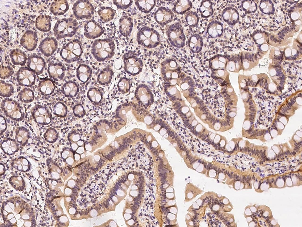 TIPRL / TIP Antibody