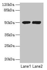 TUBA3E / Tubulin Alpha 3E Antibody