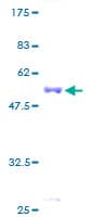 Human Endothelin 3 / EDN3 Protein (Recombinant GST)