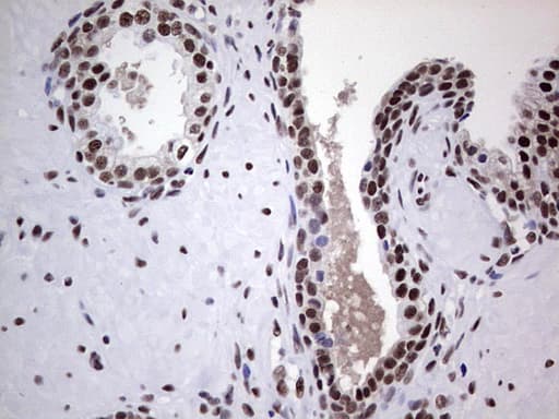 Monoclonal Mouse anti-Human PPP1R8 / Rnase E Antibody (clone OTI4E5, aa1-225, IHC, WB)