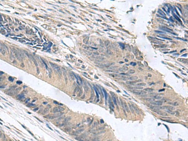 Polyclonal Rabbit anti-Human NPHP1 / Nephronophthisis Antibody (IHC, WB)