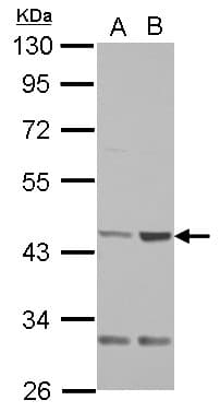 IHC-plus™ Polyclonal Rabbit anti-Human QTRT1 Antibody (IHC, WB)