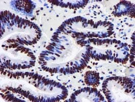 GSTT2 Antibody (clone OTI3B6)