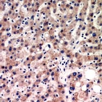 Polyclonal Rabbit anti-Human FDXR Antibody (IHC, WB)