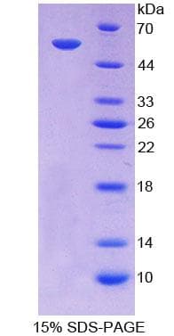 Mouse ABCA13 Protein (Recombinant His-GST)