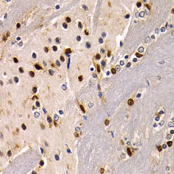 SOX2 Antibody