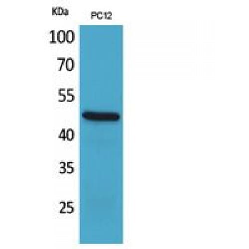 FOXP3 Antibody (381-430 aa, C-terminal)