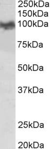 PathPlus™ APP / Beta Amyloid Precursor Antibody (N-Terminus)
