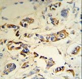 Polyclonal Rabbit anti-Human Complement C1QA Antibody (aa198-227, IHC, WB)