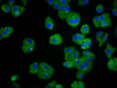 TREH Antibody