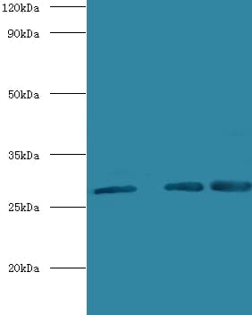 CA1 / Carbonic Anhydrase I Antibody