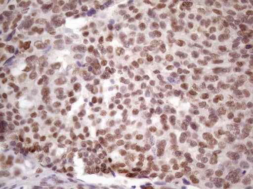 IKBKE / IKKI / IKKE Antibody (aa474-716, clone OTI3C5)