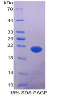 Human AATK / AATYK Protein (Recombinant His-T7)