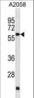 Polyclonal Rabbit anti-Human PDK3 Antibody (aa1-30, WB)