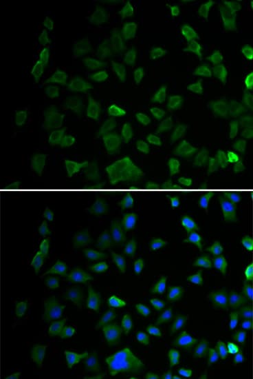 MAP2K1 / MKK1 / MEK1 Antibody