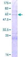 Human GORAB / SCYL1BP1 Protein (Recombinant GST)