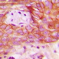 PPP1R14C / KEPI Antibody (Internal)
