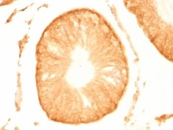 UCHL1 / PGP9.5 Antibody (clone UCHL1/775)