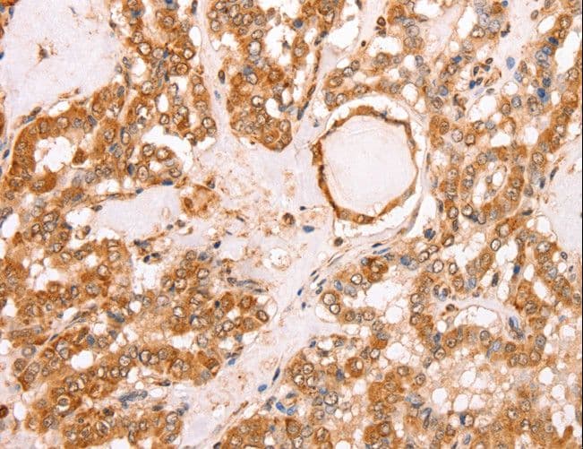 Polyclonal Rabbit anti-Human TAX1BP1 Antibody (IHC)
