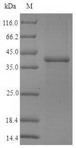 Human SFTPA1 / Surfactant Protein A (Recombinant 10His-B2M, N-terminus + Myc, C-terminus)