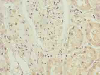 Polyclonal Rabbit anti-Human ZNF596 Antibody (IHC)