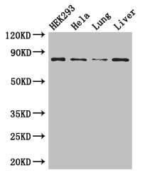 Polyclonal Rabbit anti-Human MLH1 Antibody (IHC, IF, WB)
