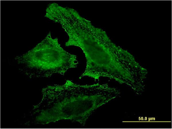 Monoclonal Mouse anti-Human UVRAG Antibody (clone 2E8, IF, WB)