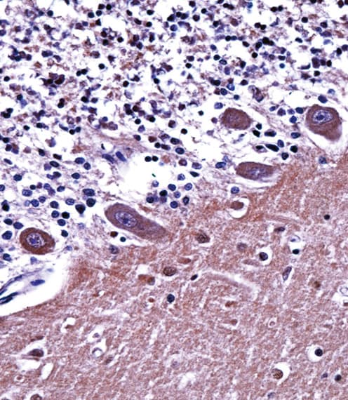 Polyclonal Rabbit anti-Human AP2A1 / AP2-Alpha Antibody (aa706-735, IHC, WB)
