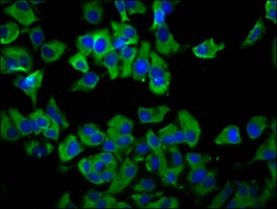 Polyclonal Rabbit anti-Human TMEM231 Antibody (IF)