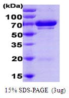 Human UBE2L3 / UBCH7 Protein (Recombinant)