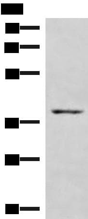 HOXD9 Antibody