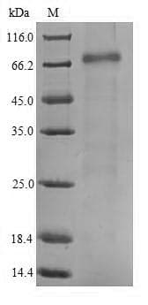 Human DCP1B Protein (Recombinant 6His, N-terminus)