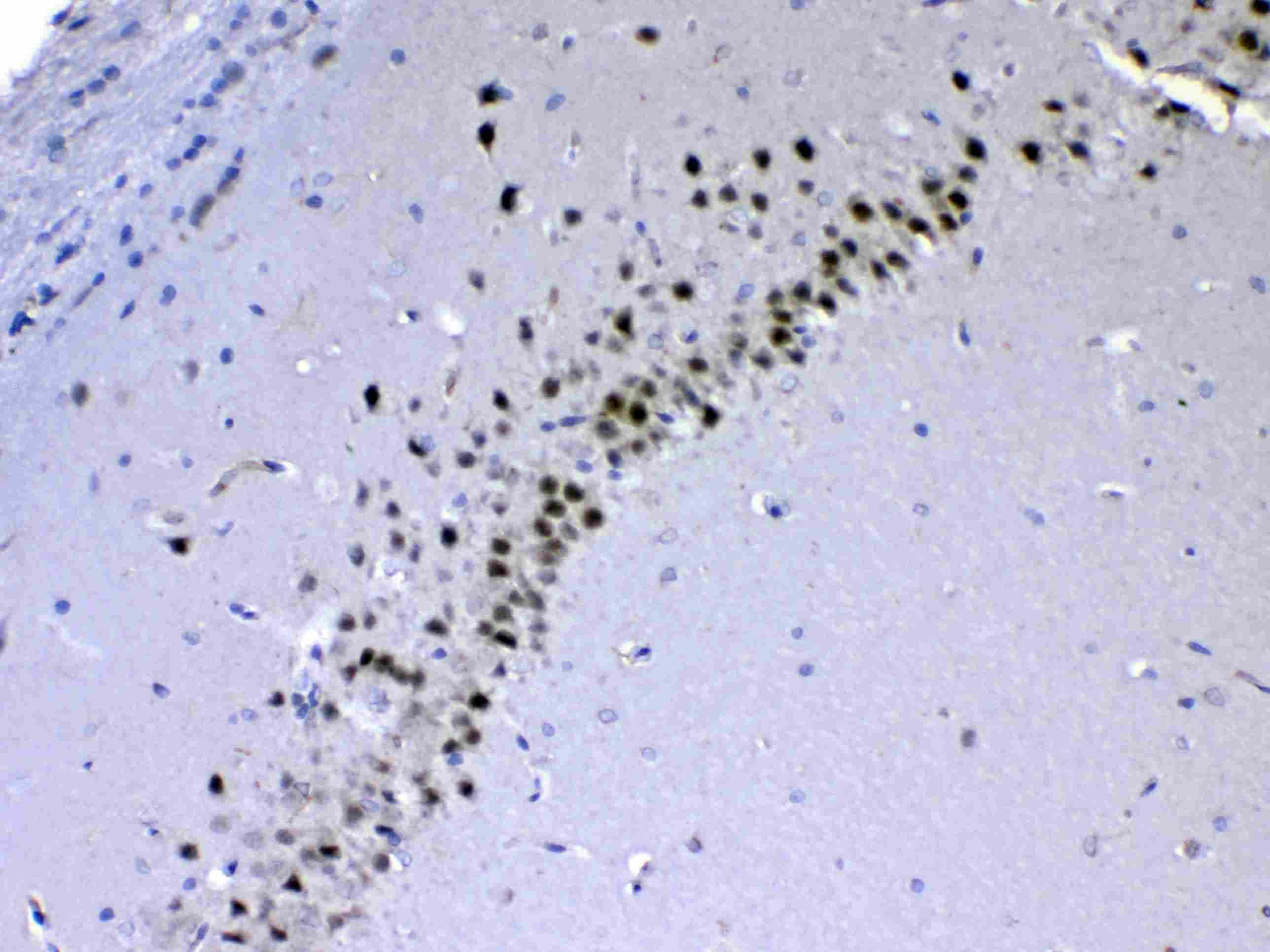 Polyclonal Rabbit anti-Human CHD2 Antibody (IHC, WB)