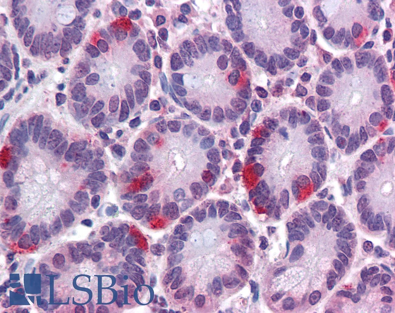 IHC-plus™ SAR1A / SAR1 Antibody (aa105-117)