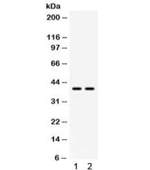 Polyclonal Rabbit anti-Human ADA / Adenosine Deaminase Antibody (IHC, WB)
