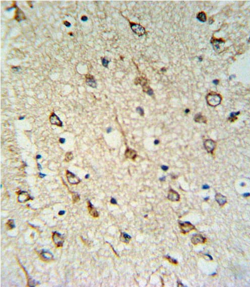 DNAJC6 Antibody (aa254-281)