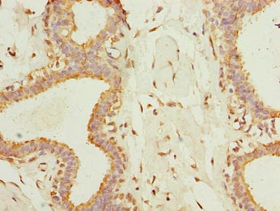 Polyclonal Rabbit anti-Human TMEM161A Antibody (IHC, WB)