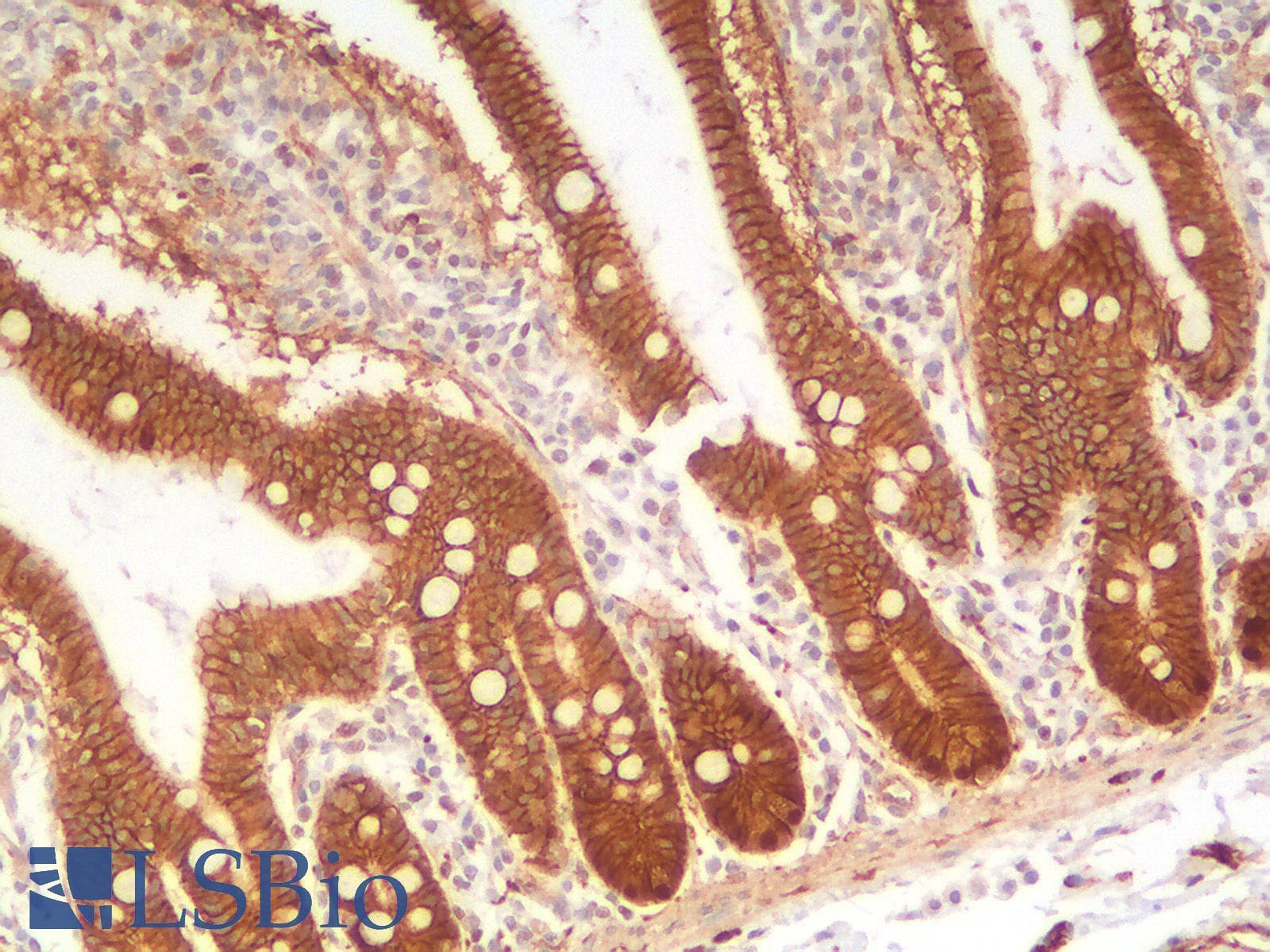 PathPlus™ CTNNB1 / Beta Catenin Antibody (clone rCTNNB1/2173)