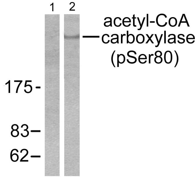 Polyclonal Rabbit anti-Human Acetyl-CoA Carboxylase / ACC Antibody (phospho-Ser80, IHC, WB)
