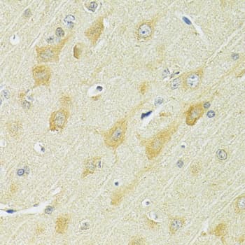 Polyclonal Rabbit anti-Human SLC25A1 / SEA Antibody (IHC, WB)