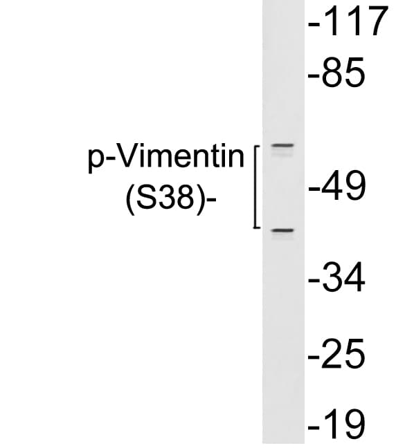 Vimentin Antibody (phospho-Tyr38)
