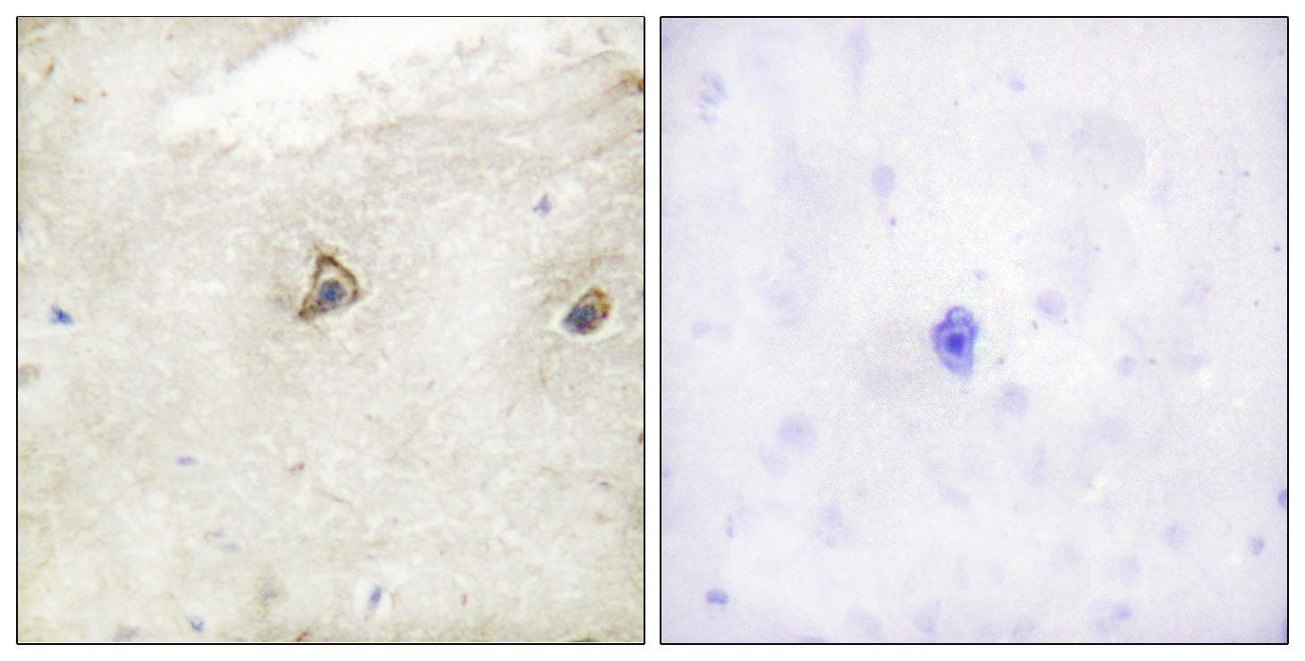 Polyclonal Rabbit anti-Human ABL1 / c-ABL Antibody (IHC)