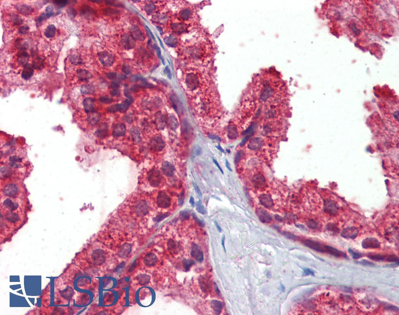 IHC-plus™ CLIP1 / CLIP-170 Antibody (aa1404-1417)